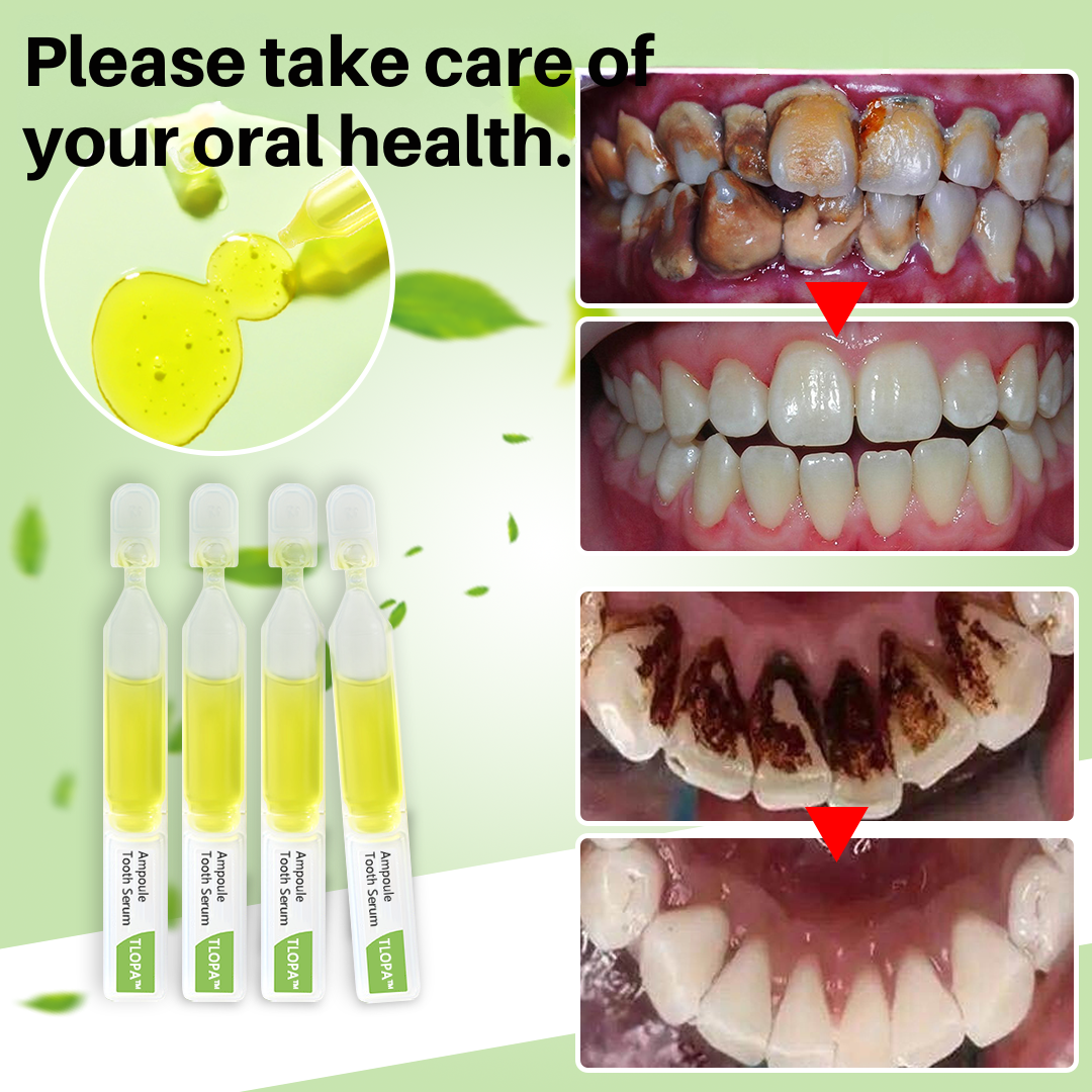 Brighten Your Smile | Tartar Removal | Natural Ingredients | PureGlow