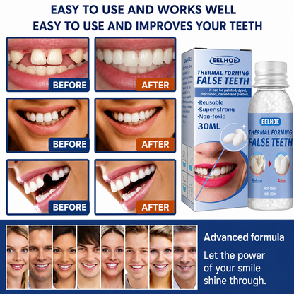 Instant Smile Repair Kit | Fill Gaps & Boost Confidence