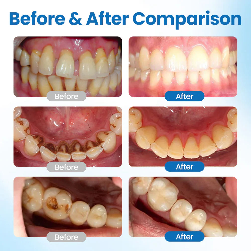 Defend Your Smile | Advanced Dental Shield Serum