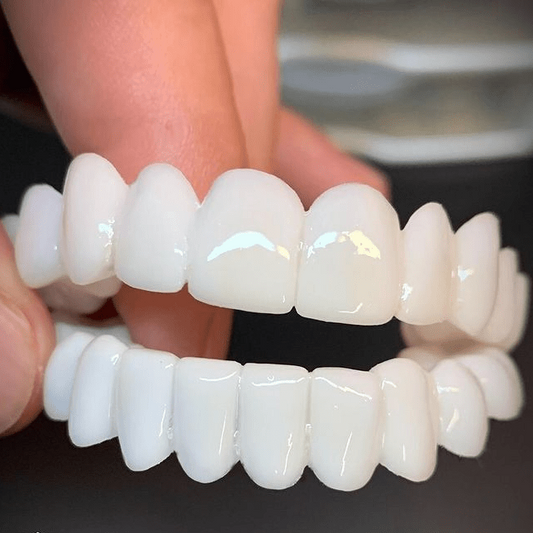 Dental Prosthesis with White Tooth Covers
