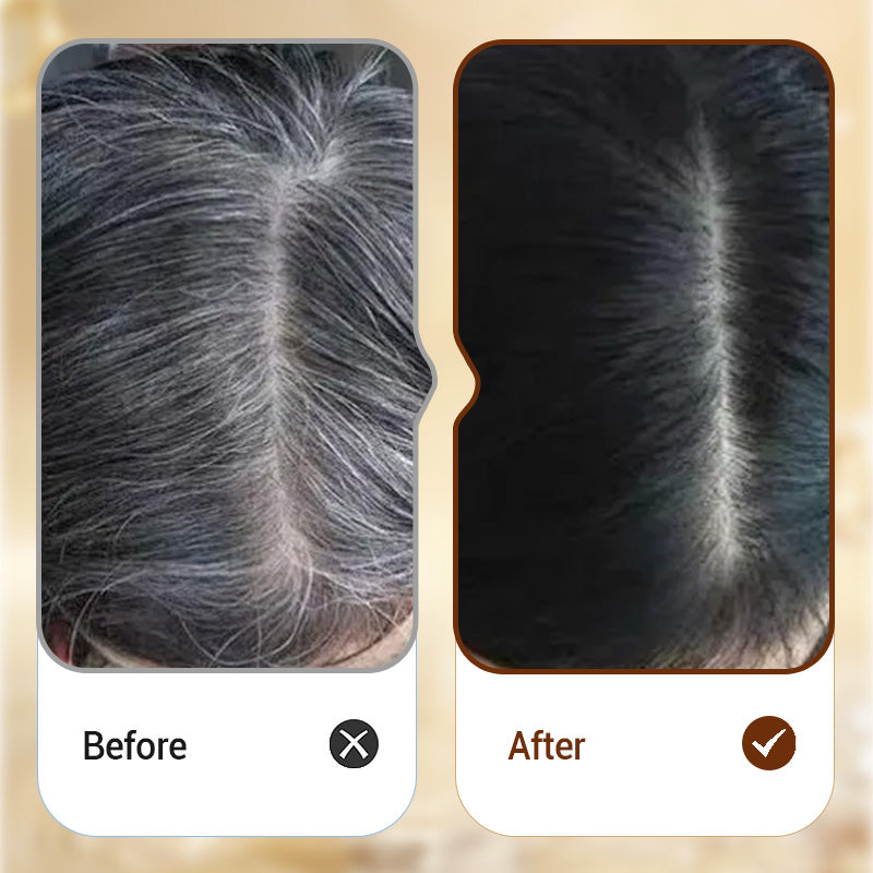 Instant Gray Hair Removal for a Youthful Look