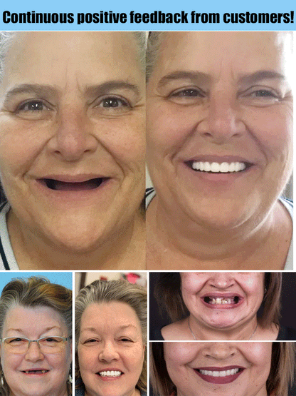Effortless Natural Comfort for Confident Smiles All Day Long