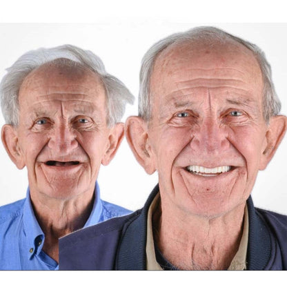 Affordable Flexible Comfort Denture Set for a Natural Smile