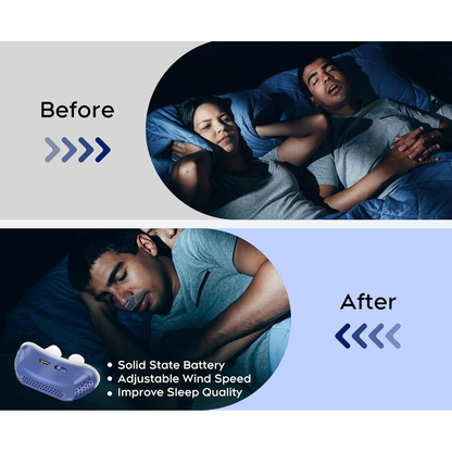 Rechargeable Nasal Dilator for Snoring and Sleep Apnea Relief