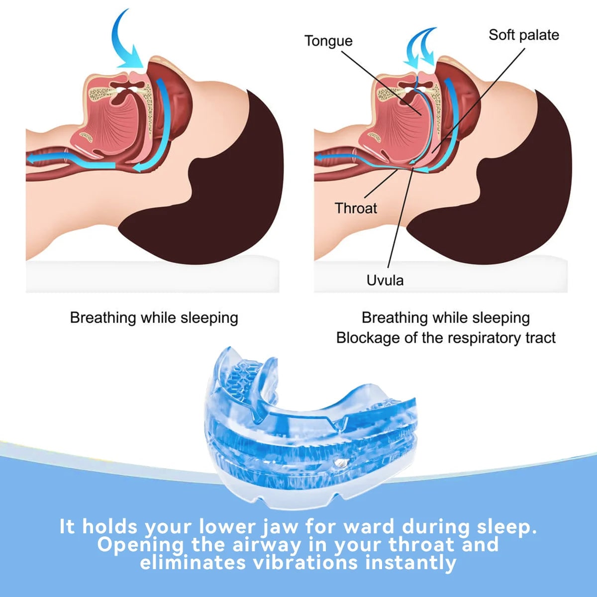 Customizable Snoring Relief Mouthpiece with Case & Tool