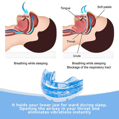 Customizable Snoring Relief Mouthpiece with Case & Tool