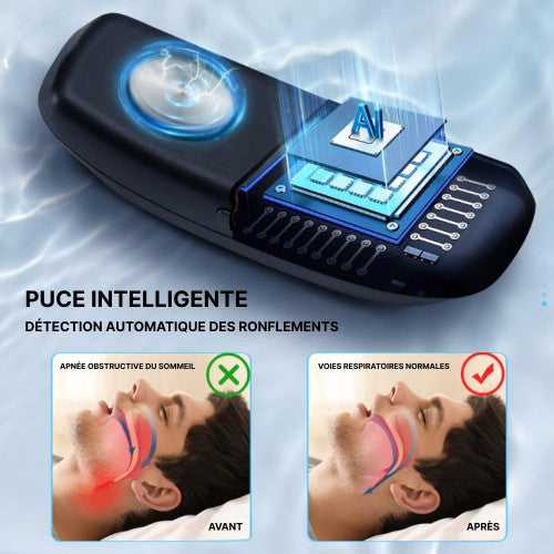 Comfortable and Effective Anti-Snoring Device