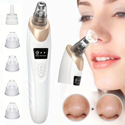 Blackhead Remover - Professional Facial Cleansing - Radiant Skin