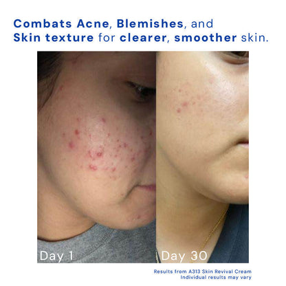 Revitalize Night Cream with Retinol for Radiant Skin