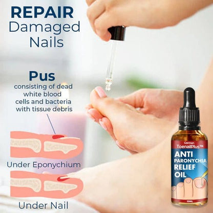 NailCare Relief Oil for Effective Ingrown Toenail Treatment