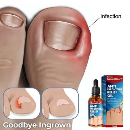 NailCare Relief Oil for Effective Ingrown Toenail Treatment
