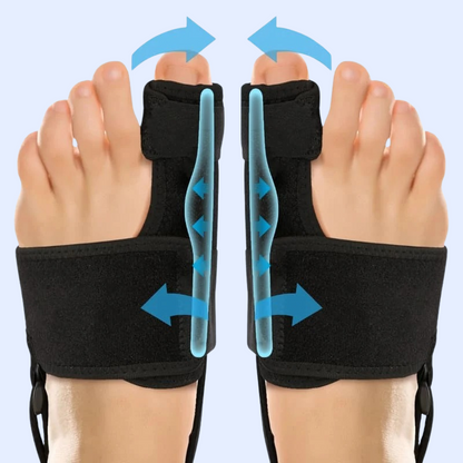 Toe Alignment Support for Enhanced Comfort and Mobility