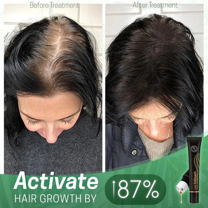 Nourishing Scalp Serum with Roller Applicator for Lush Hair