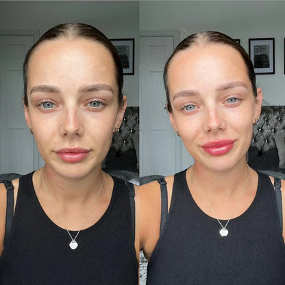 Achieve Fuller Lips Quickly with Lip Plumper Serum