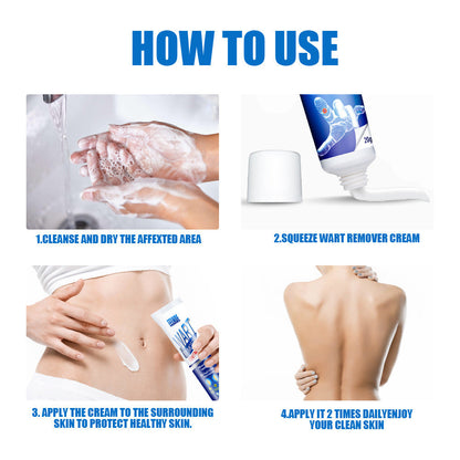 Wart Removal Cream – Fast and Efficient Treatment