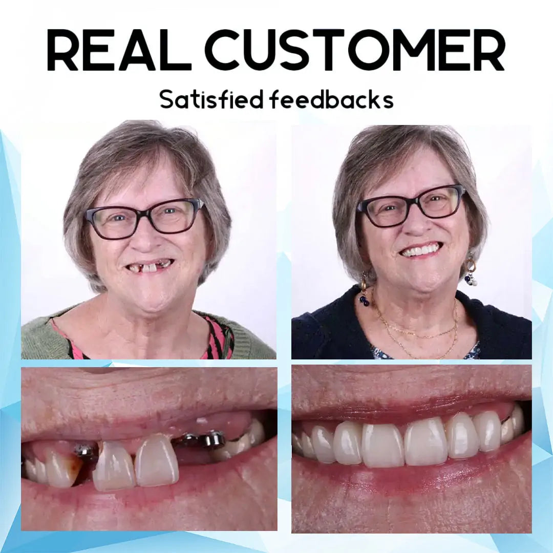 SmileMend™ – Custom Silicone Denture Solution for a Perfect Smile