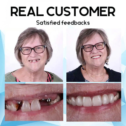SmileMend™ – Custom Silicone Denture Solution for a Perfect Smile