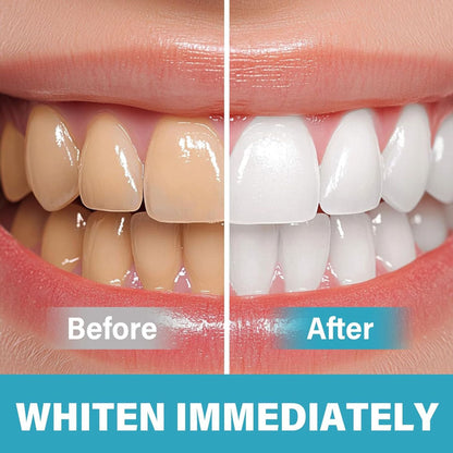 Instant Smile Brightening Serum for Sensitive Teeth