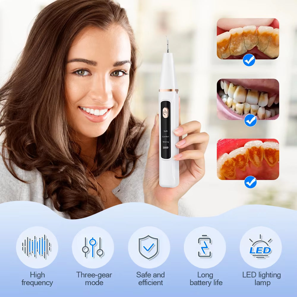 Plaque and Tartar Remover with High-Frequency Sound Wave Technology