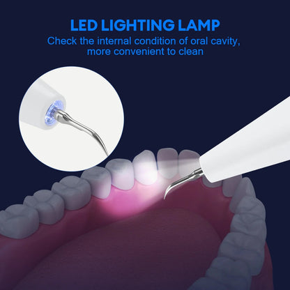 Plaque and Tartar Remover with High-Frequency Sound Wave Technology