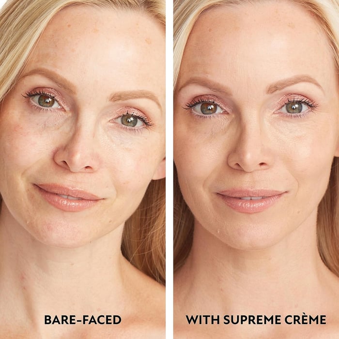 RadiantGlow – Hydrating Concealer for Natural Flawless Finish