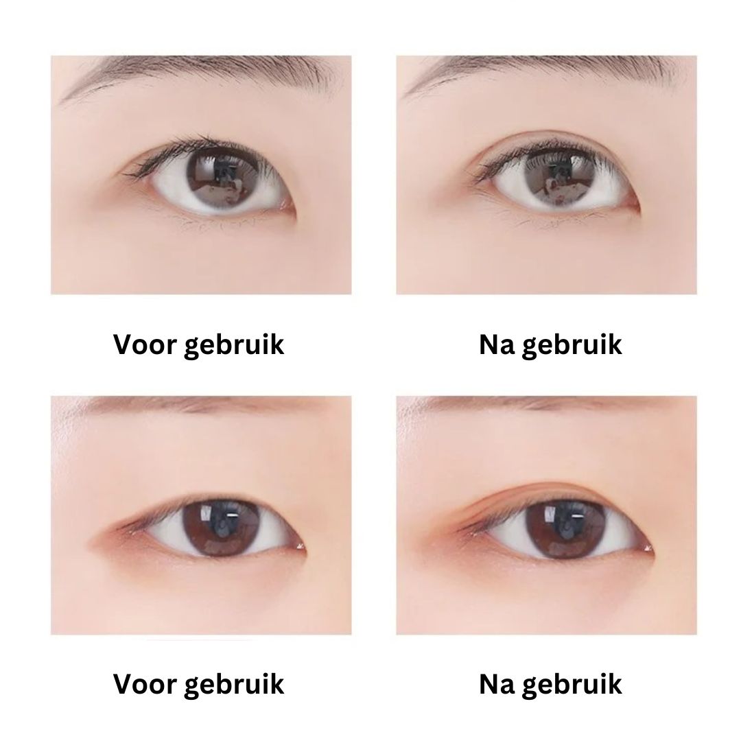 Double Eyelid Tape for Droopy Lids | Unisex
