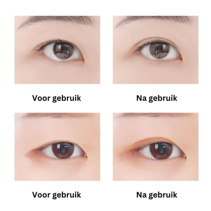 Double Eyelid Tape for Droopy Lids | Unisex
