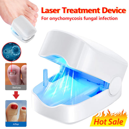 Home Laser Nail Care Device - User-Friendly Design