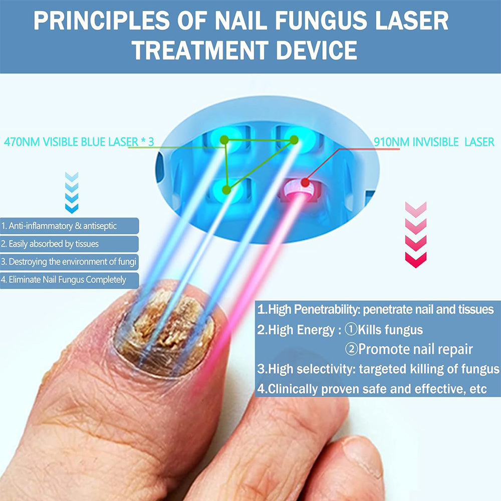 Home Laser Nail Care Device - User-Friendly Design