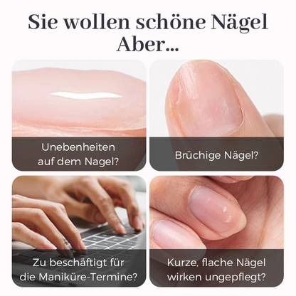Nail Base Gel for All Skill Levels – Ideal for Beginners and Experts