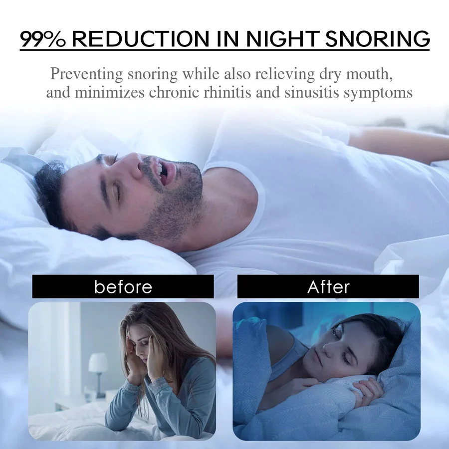 SleepGuard Breathable Strips for Snoring Relief