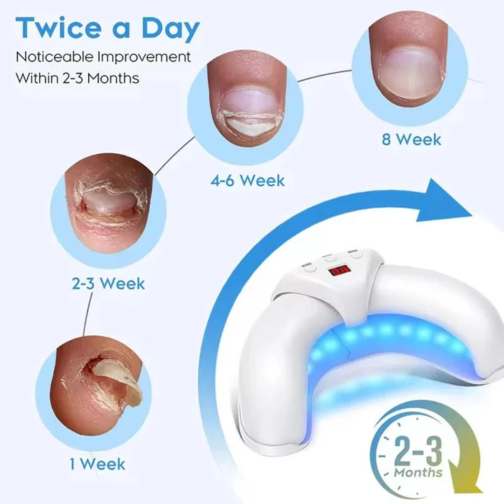 Nail Fungus Treatment Laser Device