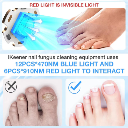 Nail Fungus Treatment Laser Device
