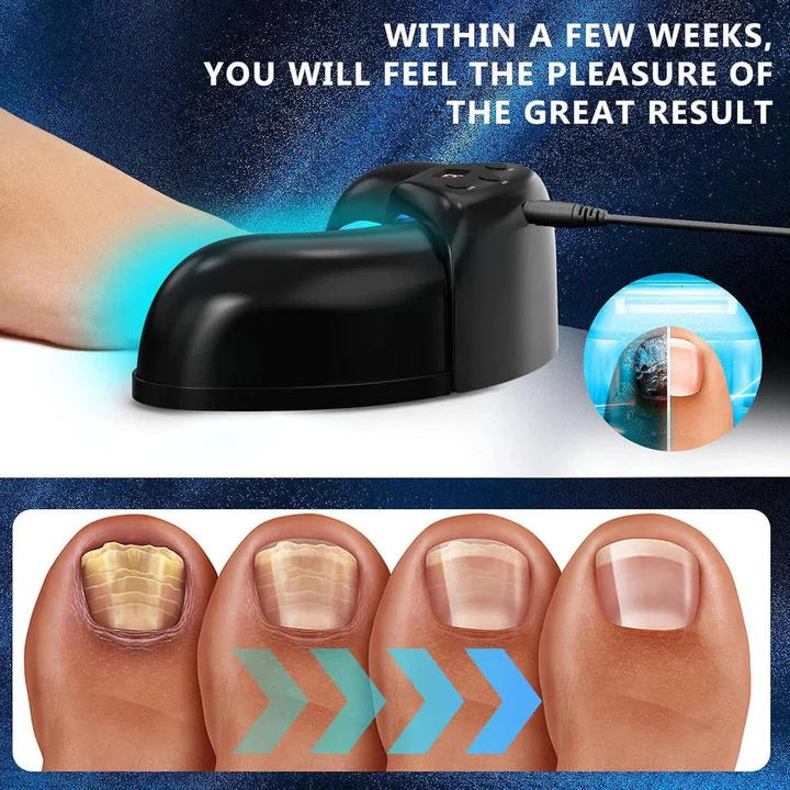 Nail Fungus Treatment Laser Device