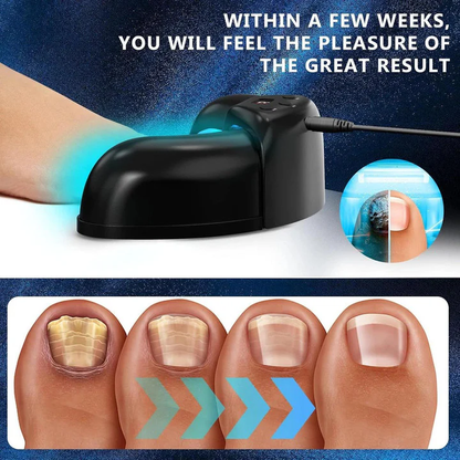 Nail Fungus Treatment Laser Device