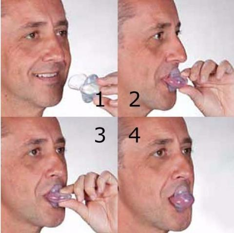 Tongue Stabilizer for Sleep Apnea Management Device