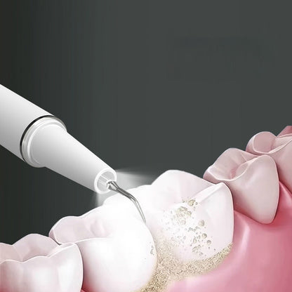 Instant Stain Remover for Teeth – Achieve a Bright Smile