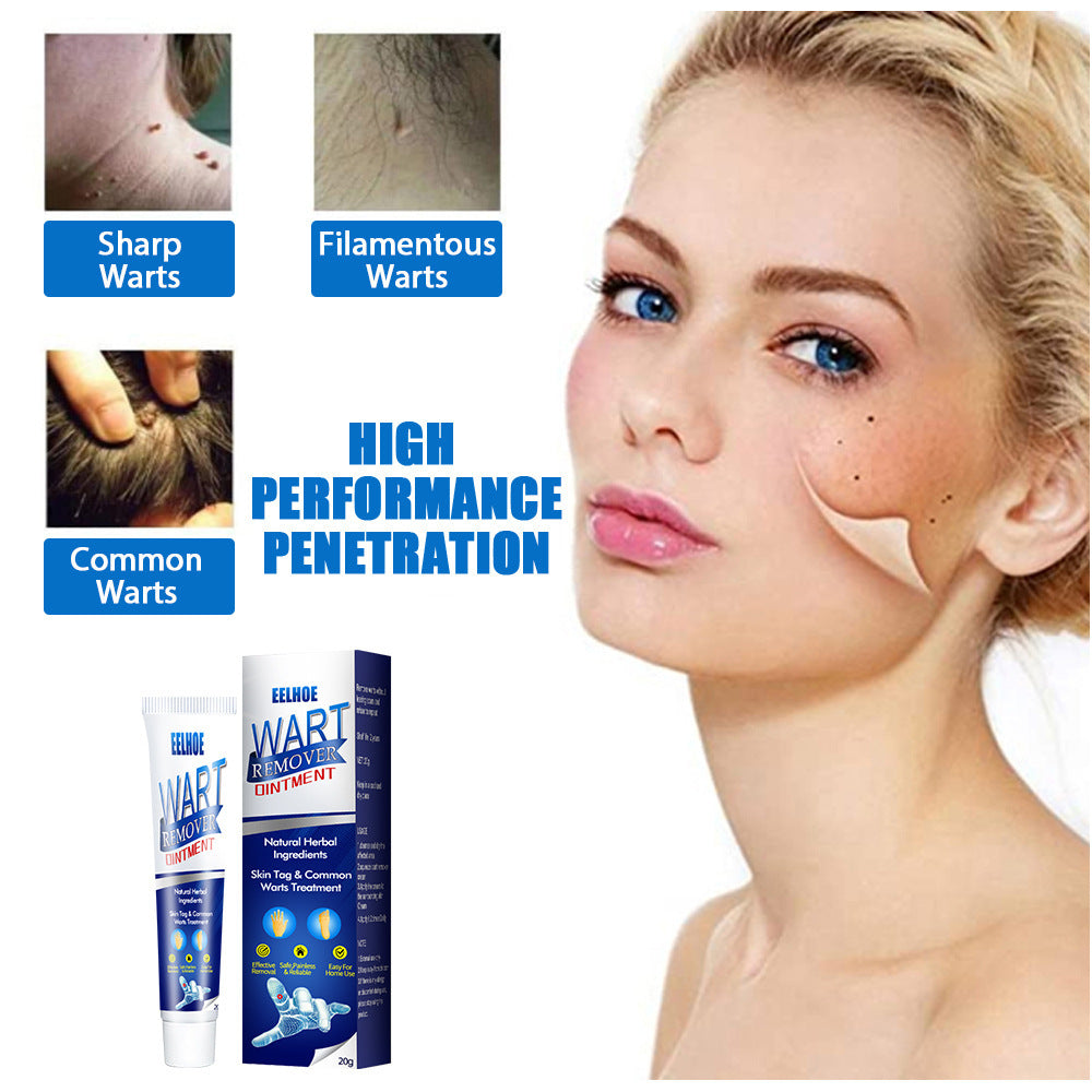 Wart Removal Cream – Fast and Efficient Treatment