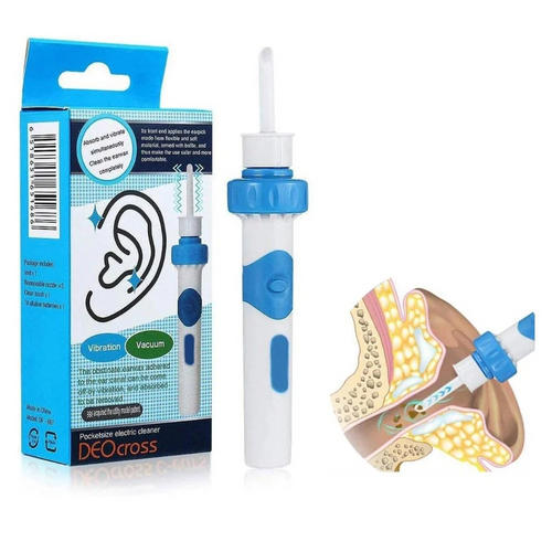 Gentle Ear Wax Remover – Ear Vacuum Cleaner
