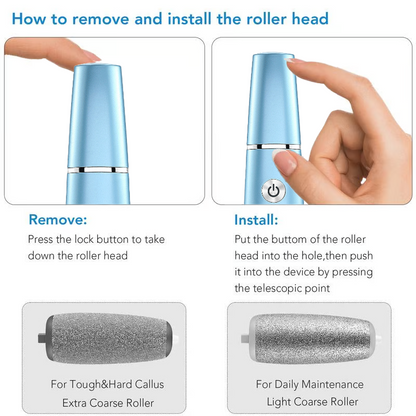 Rechargeable Foot Care System with Exfoliating Roller