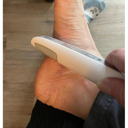 Rechargeable Foot Care System with Exfoliating Roller