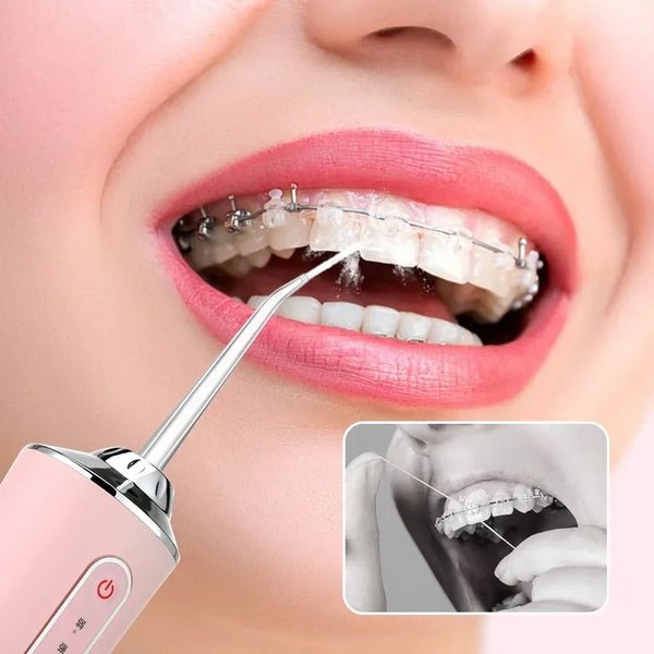 Advanced Oral Irrigator with 3 Cleaning Settings | Rechargeable Water Flosser for Gum Care | IPX7 Waterproof