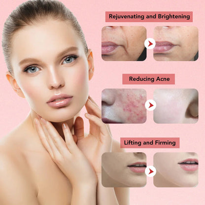 Facial Lifting Device