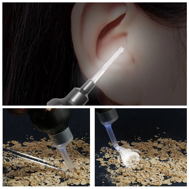 5-in-1 Electric Earwax Cleaner Tool