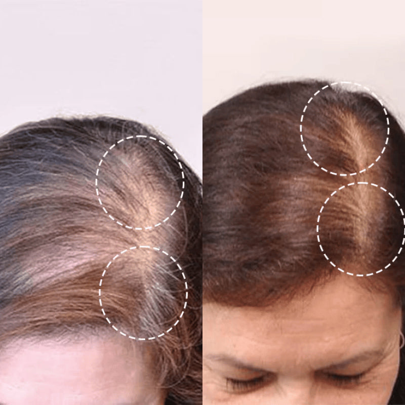 Scalp Massager for Hair Growth with Red Light Therapy – UK