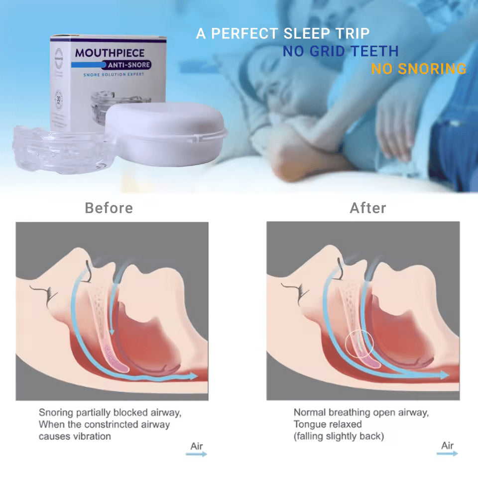 Adjustable Snoring Prevention Device for UK Users