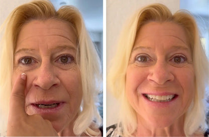 Double Eyelid Tape for Droopy Lids | Unisex