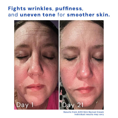 Revitalize Night Cream with Retinol for Radiant Skin