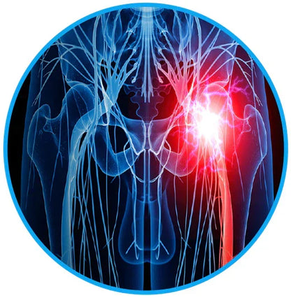 Sciatica Relief Belt - Alleviate Your Back and Nerve Pain