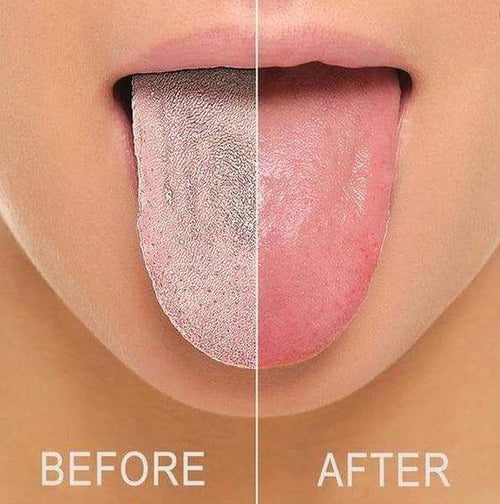 Flexible Oral Care Device